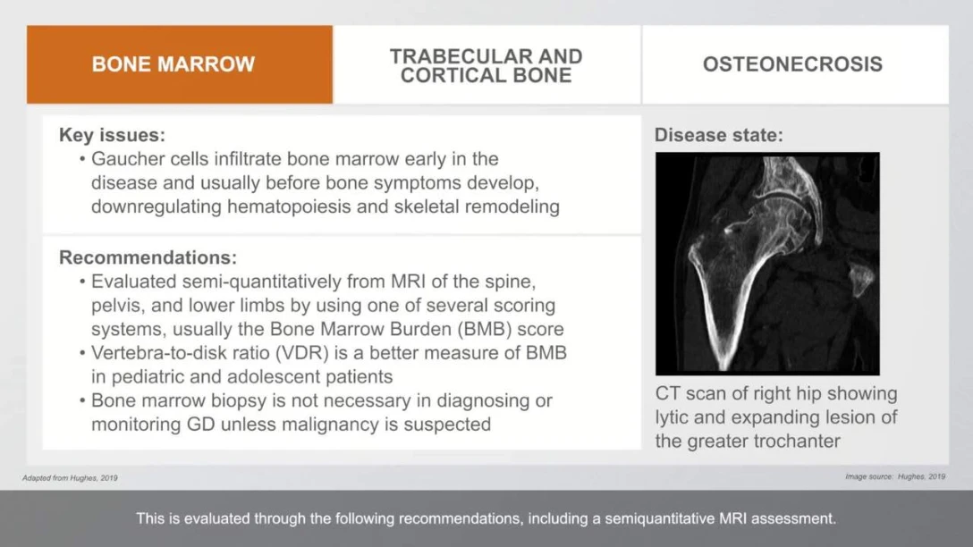 Bone_Monitoring_Guidelines_for_GD_animation_video_D0519103