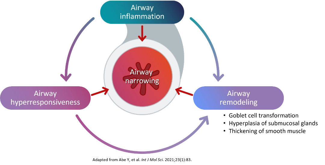 Airway narrowing
