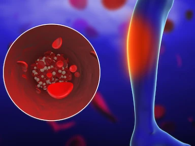 Approach for Patients with PAD and T2D: Focus on LDL-C Control
