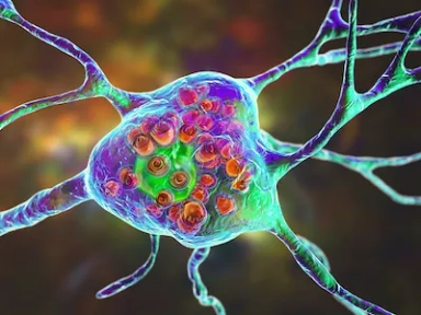 Expert group consensus from the Arabian Peninsula on the diagnosis of LOPD