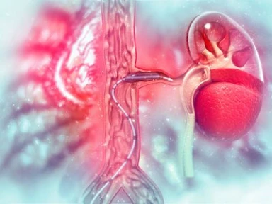 LLTs and Antithrombotic Therapy in PAD