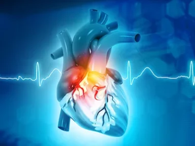 Event rates and Risk Factors for Recurrent CV Events