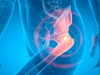 Det KORREKTA svaret är…