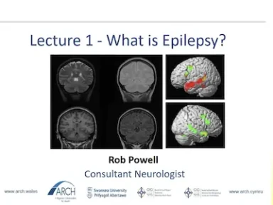 What is Epilepsy