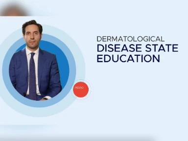 Understanding Cumulative Disease Burden in Uncontrolled AD