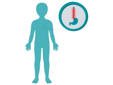 Dupilumab Maintained Histologic and Endoscopic Improvements During the Open-Label Extension Period of the EoE KIDS Study