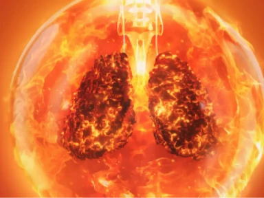 The Impact of Exacerbations in COPD