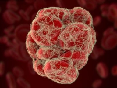 Trends in Pulmonary Embolism-related mortality in Europe