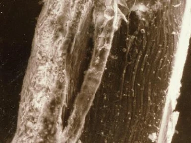 Acute Medical Illness: Advanced Age Alone Predicts Venous Thromboembolism Similar to Existing Risk Assessment Models