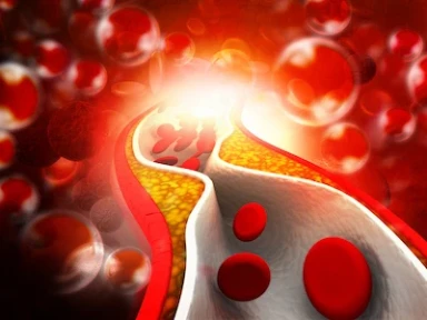 Meta Analysis of apoB Lowering and CV Risk Reduction Among Different LLTs