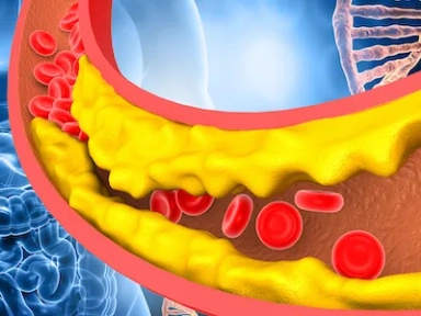 Clinical practice experience in patients with familial hypercholesterolemia (FH) from the SAFEHEART registry