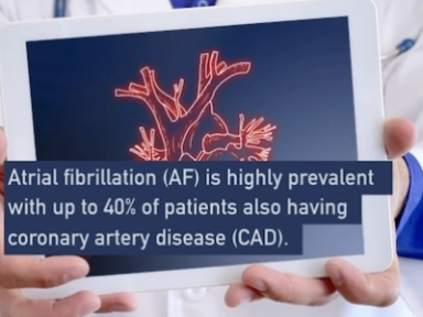Management of antithrombotic therapy in patients with AF undergoing PCI