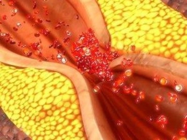 Odyssey Outcomes - Total Events Analysis