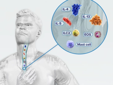 Understanding eosinophilic esophagitis (EoE)