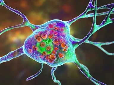 Expert Group Consensus From the Arabian Peninsula On the Diagnosis of LOPD