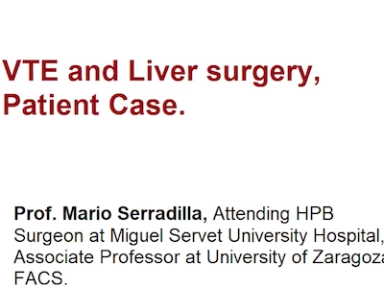 Pre vs post operative initiation of Thromboprophylaxis in Liver surgeries