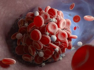 Evaluation Of Comparative Efficacy and Safety of Thromboprophylaxis Agents Among Critically Ill Patients