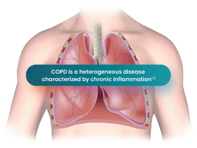 Chronic Obstructive Pulmonary Disease (COPD): Disease Burden and Heterogeneity