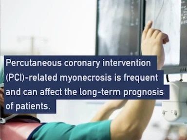 Clopidogrel as the standard of care for elective PCI: Findings from the Alpheus