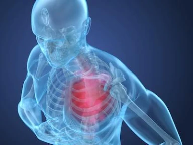 PCSK9 inhibitors and ACS