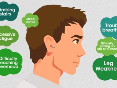 Navigating the Pompe Disease Journey