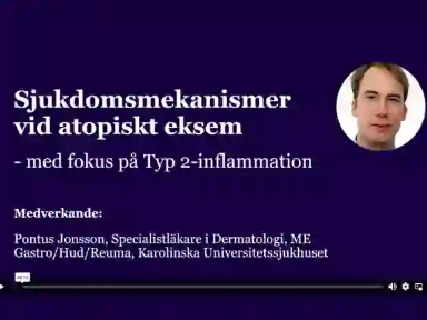 Föreläsning från 2022: Sjukdomsmekanismer vid atopiskt eksem – med fokus på typ 2-inflammation