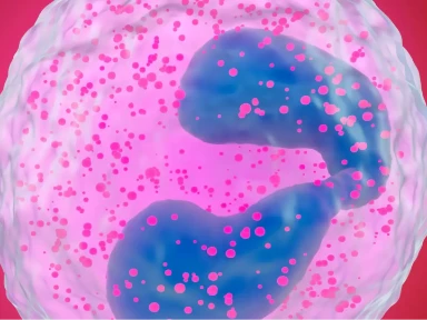 Typ 2-inflammationens roll*