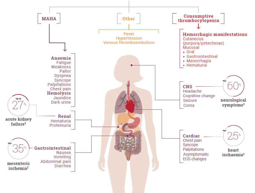 Signs and symptoms aTTP